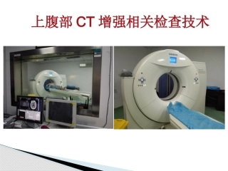 上腹部CT增强技术