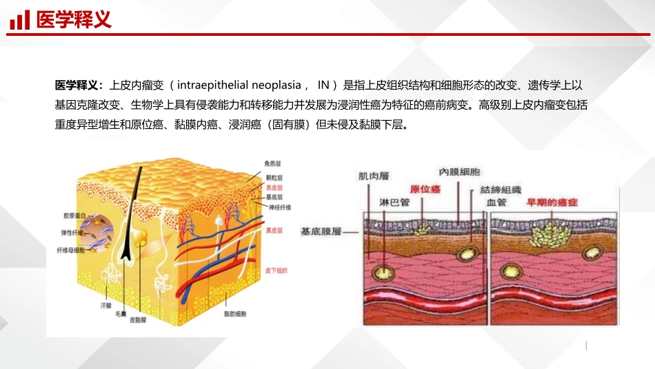上皮内瘤变及早期癌_第3页