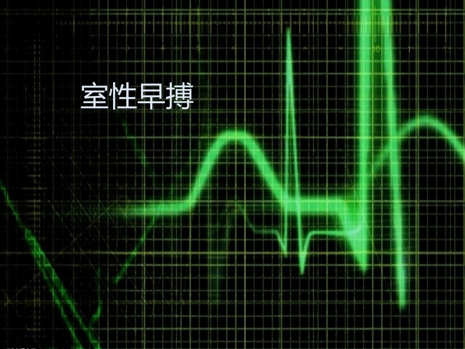 室性早搏课件_第1页