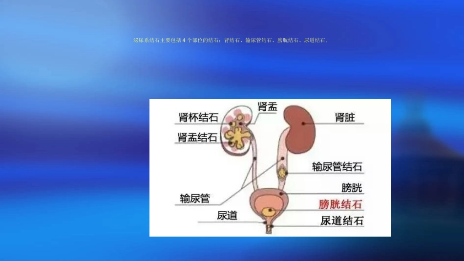 输尿管结石的超声诊疗_第2页