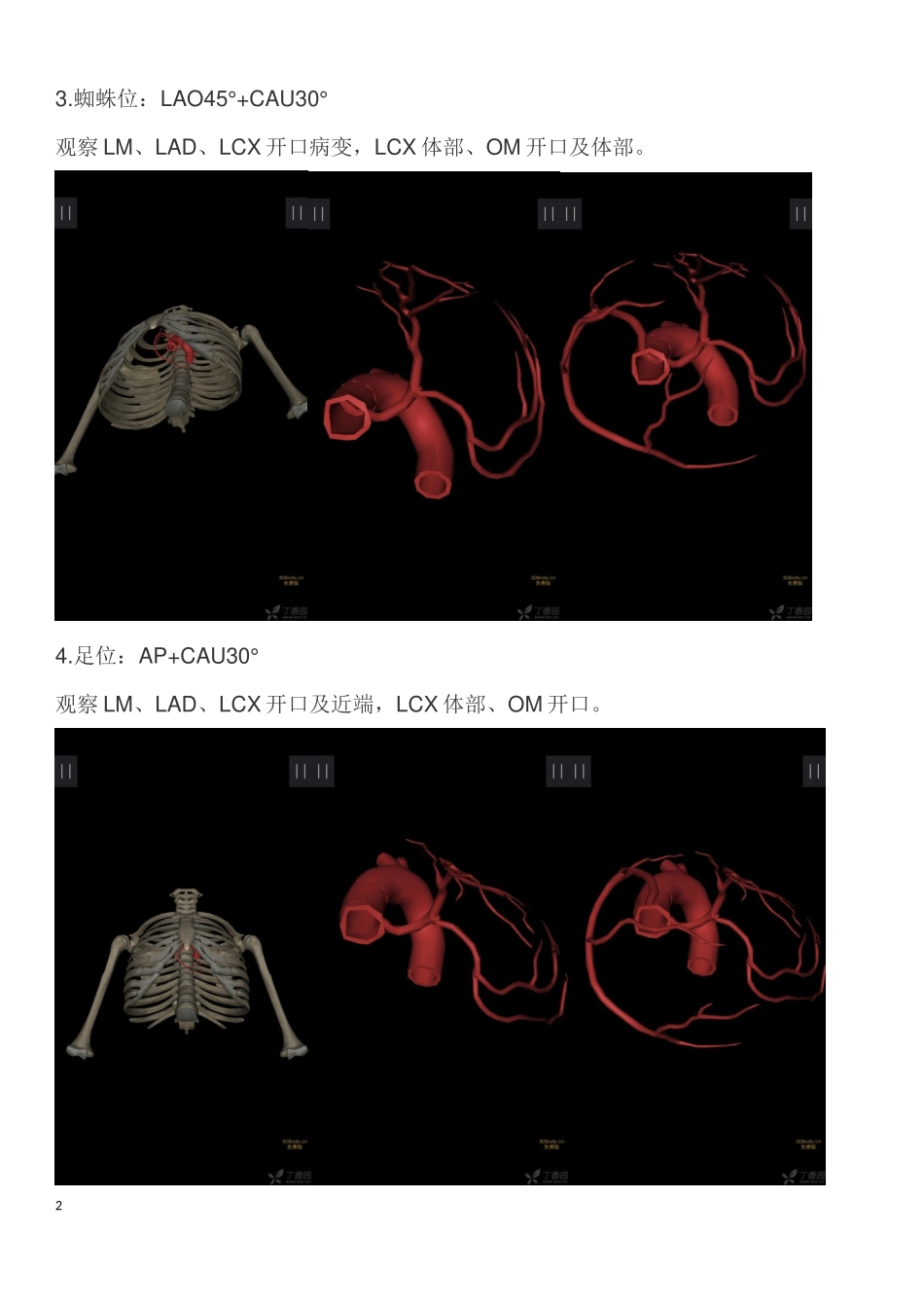 冠脉造影常用体位_第2页