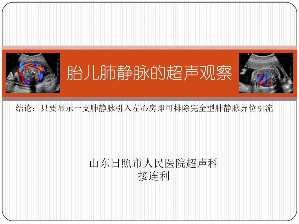 胎儿肺静脉的超声观察_第1页