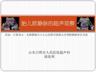 胎儿肺静脉的超声观察