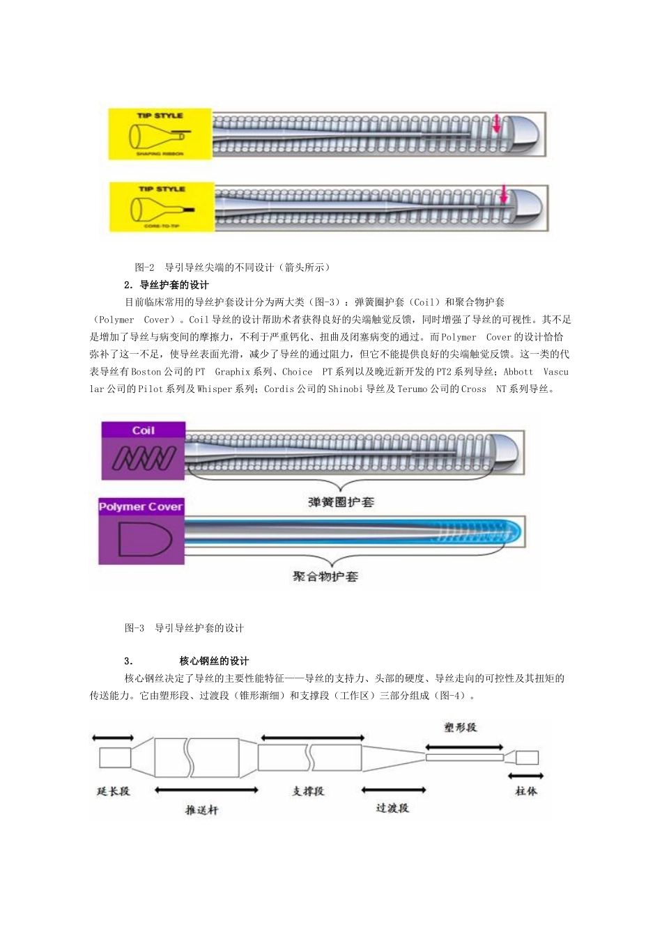 冠状动脉介入治疗中导引导丝的选择_第2页