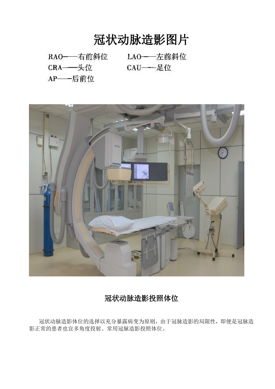 冠状动脉造影体位图片_第1页