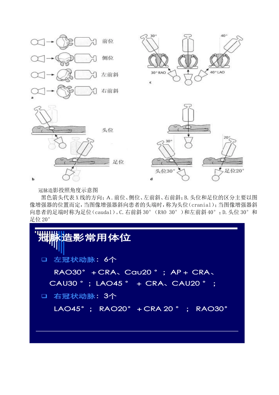 冠状动脉造影体位图片_第2页
