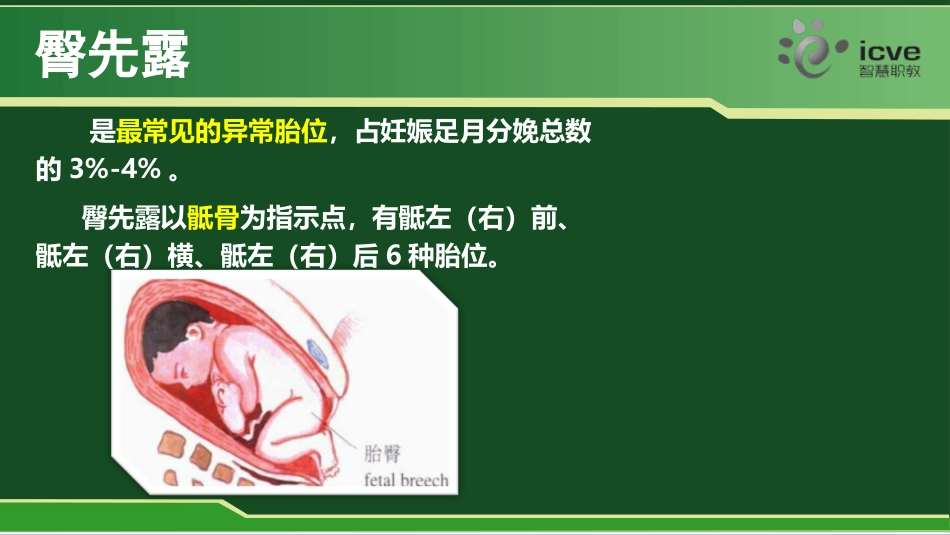 臀位护理常规_第2页