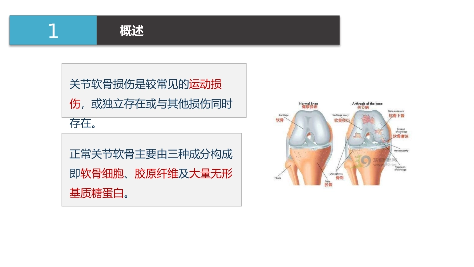 膝关节软骨损伤的康复_第3页