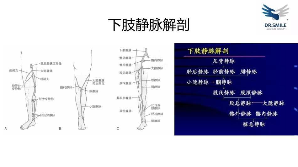 下肢静脉曲张的病理生理_第2页