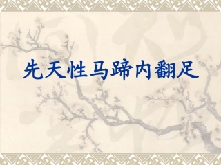 先天性马蹄内翻足