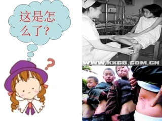 小儿肌肉注射课件