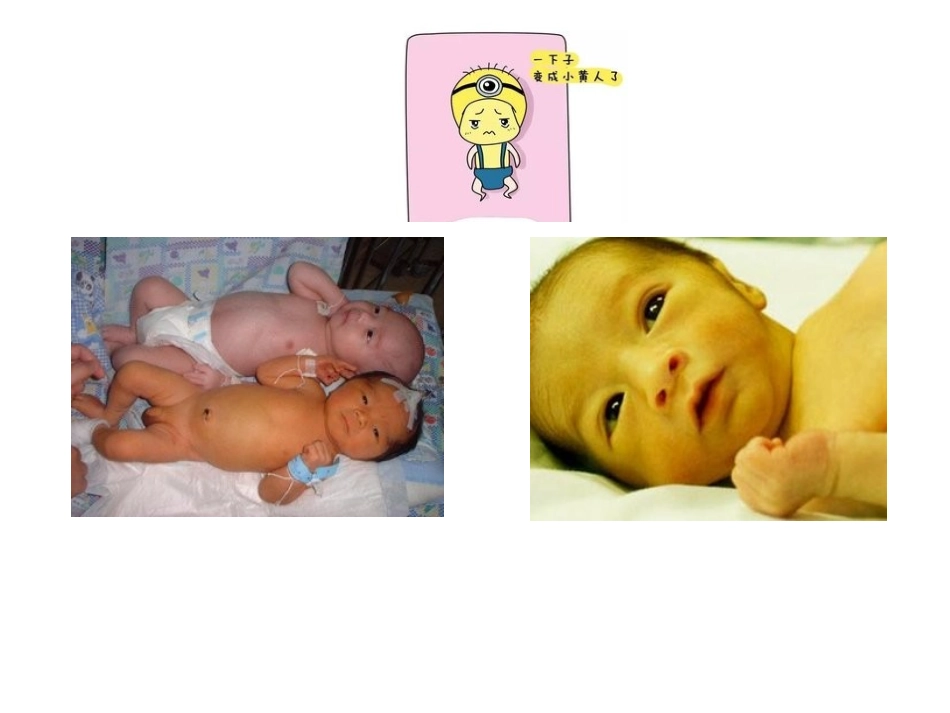 小儿推拿治疗新生儿黄疸_第2页