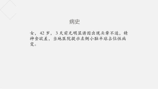 小脑发育不良节细胞瘤