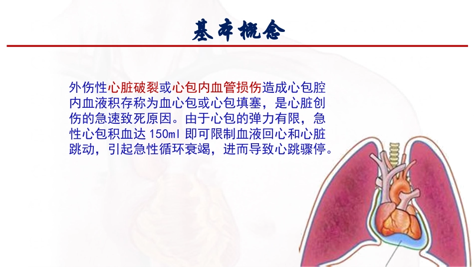 心包填塞应急预案_第3页