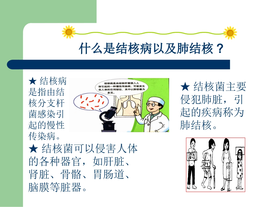 学生结核病防治知识宣传_第3页