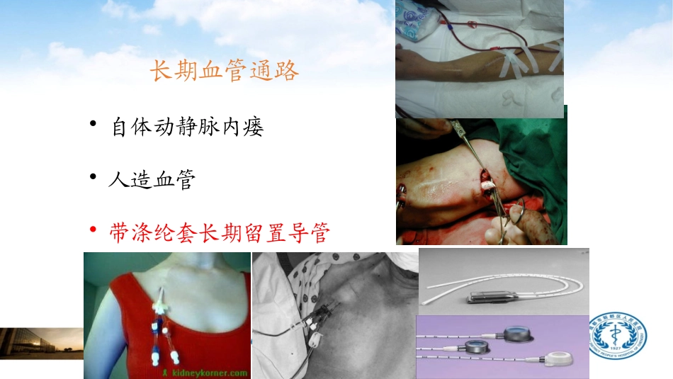 血透患者长期导管的维护_第2页