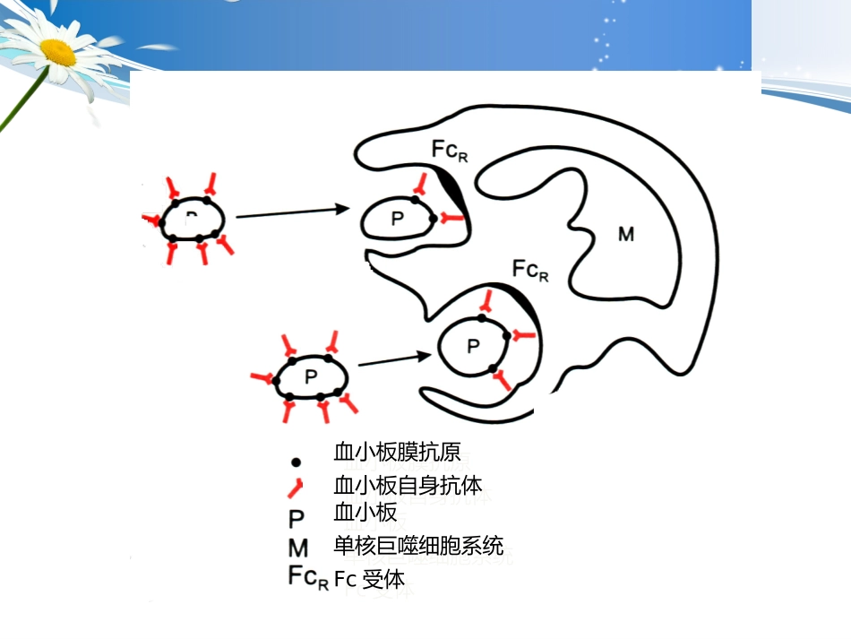 血小板减少症治疗_第2页