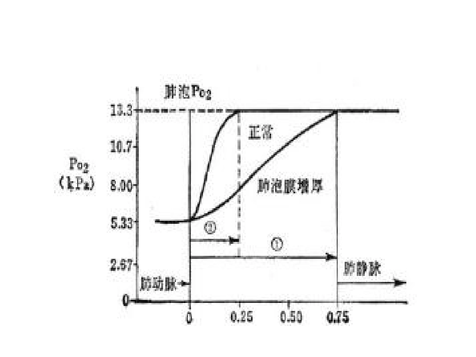 严重低氧血症的处置_第2页