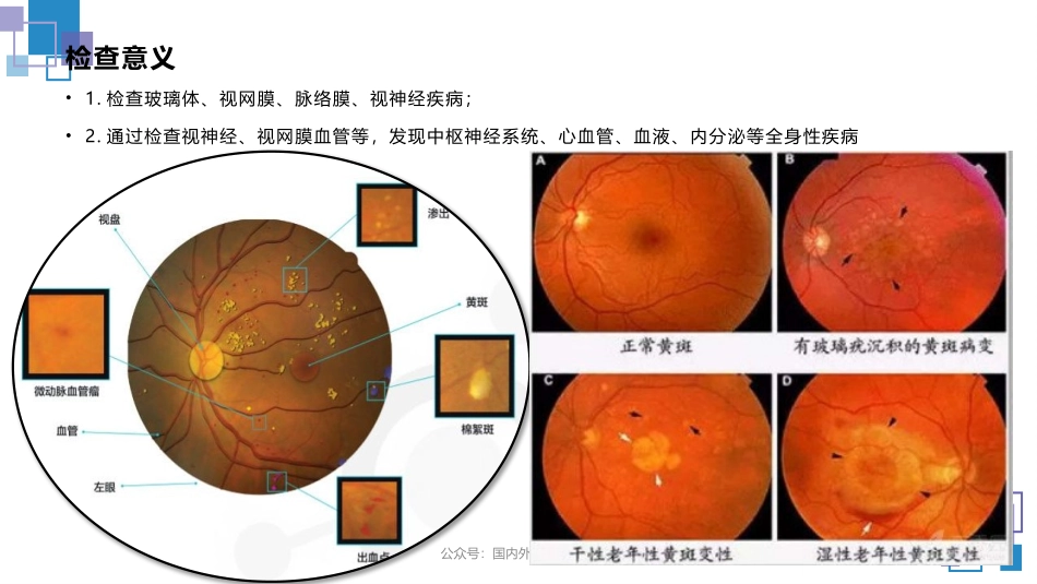 眼底镜的使用_第3页