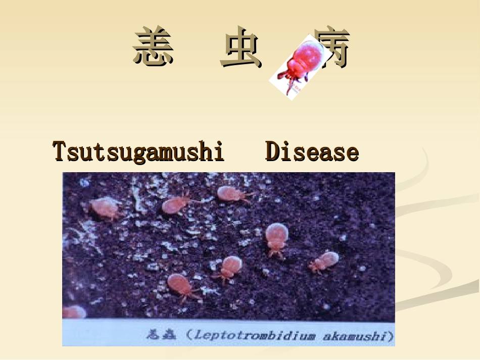 恙虫病的护理课件_第1页