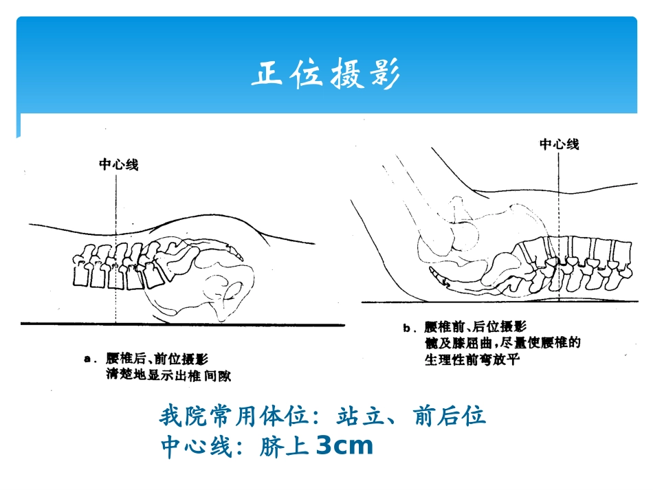 腰椎X线摄片体位_第3页