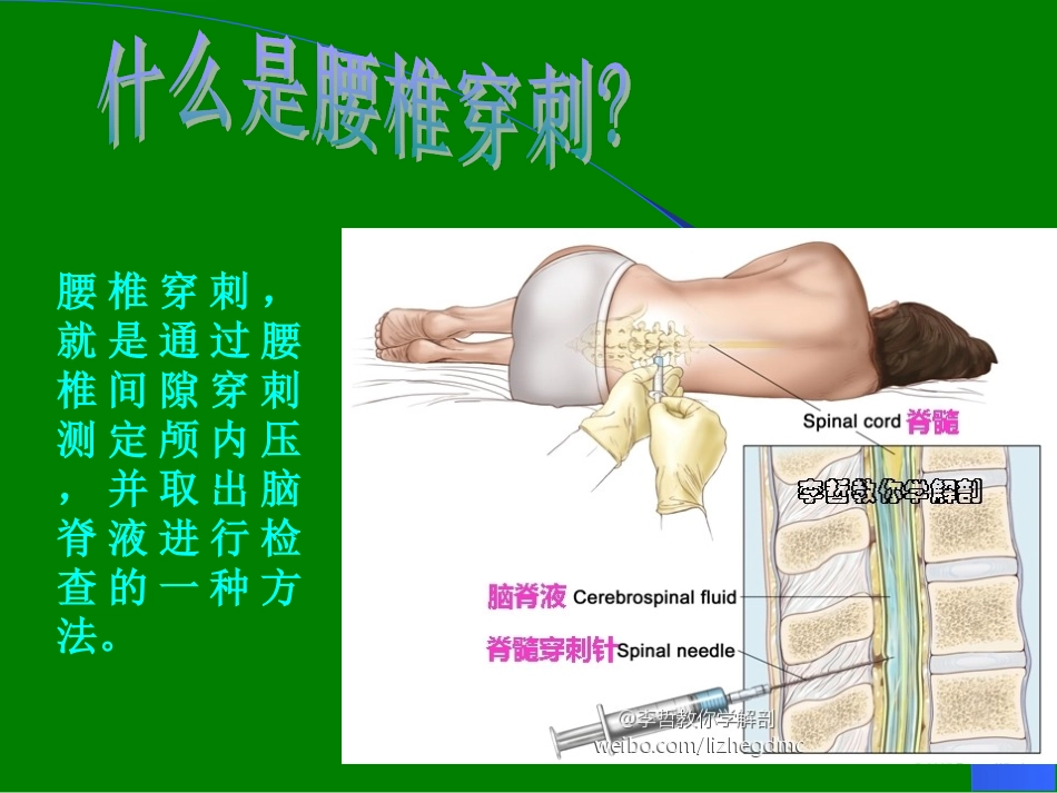腰椎穿刺课件_第3页
