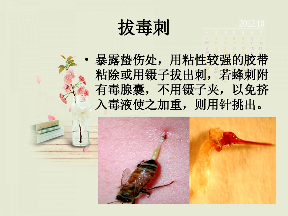 医学蜂蛰伤的急救专题课件_第3页