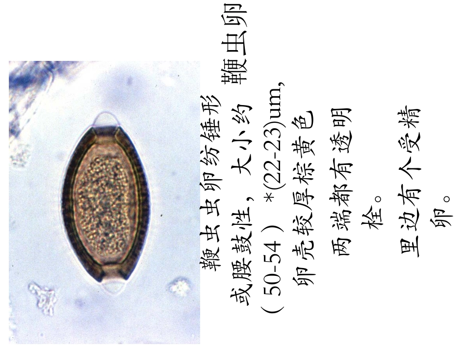 医学寄生虫学虫卵总结和图片课件_第2页