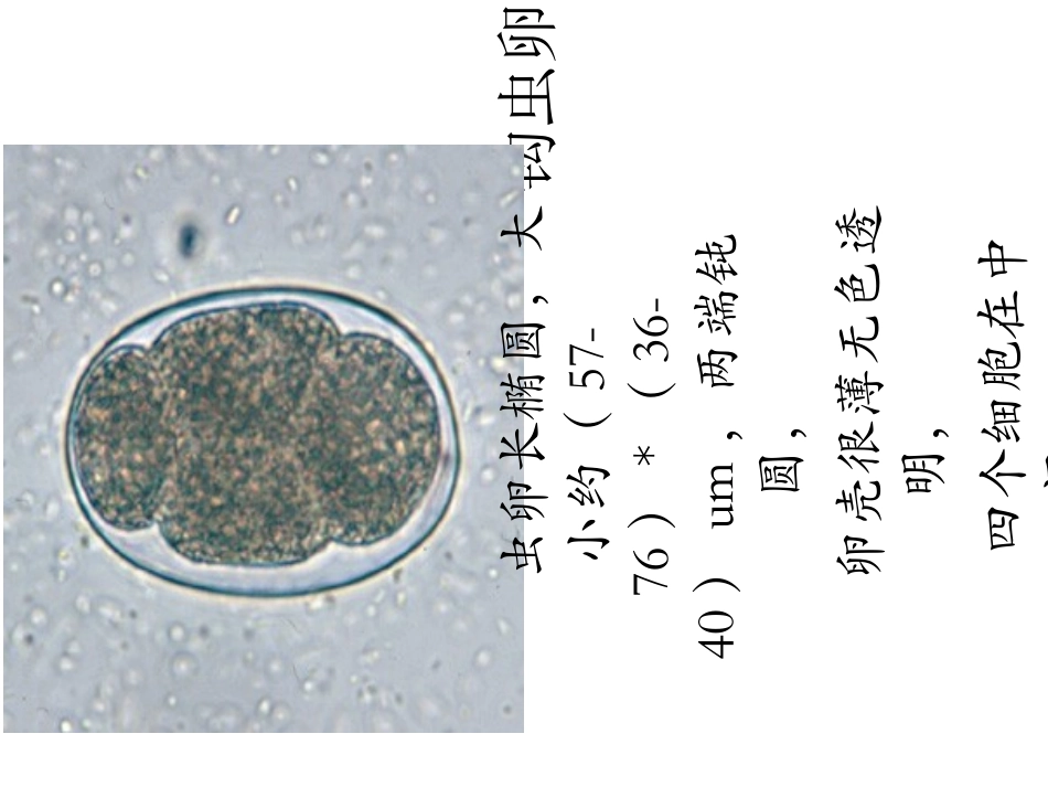 医学寄生虫学虫卵总结和图片课件_第3页
