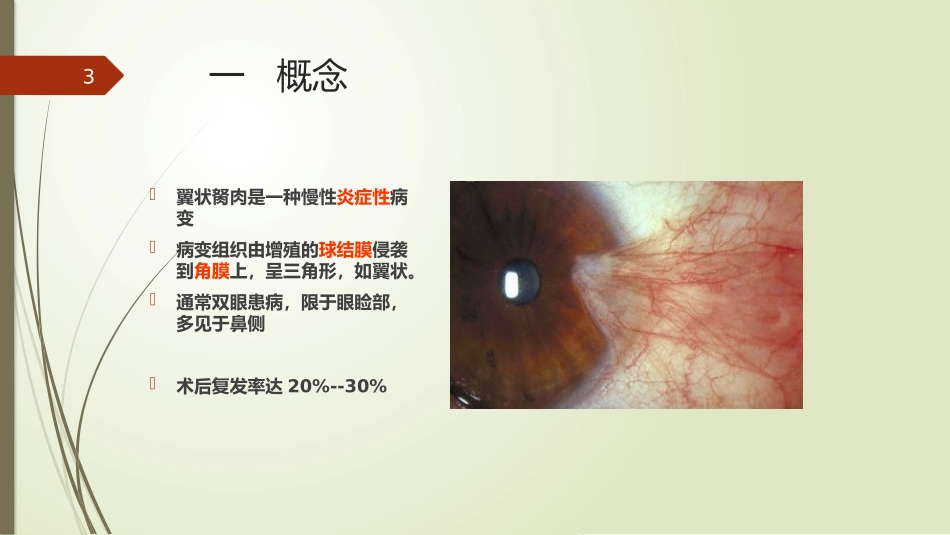 翼状胬肉的护理课件_第3页