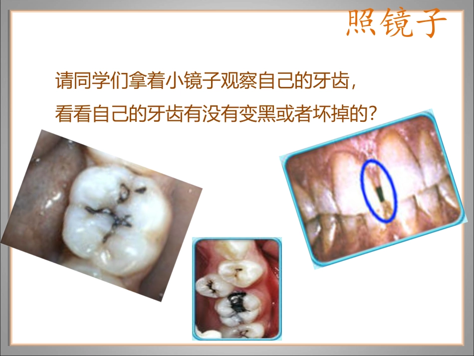 幼儿园保护牙齿课件_第3页