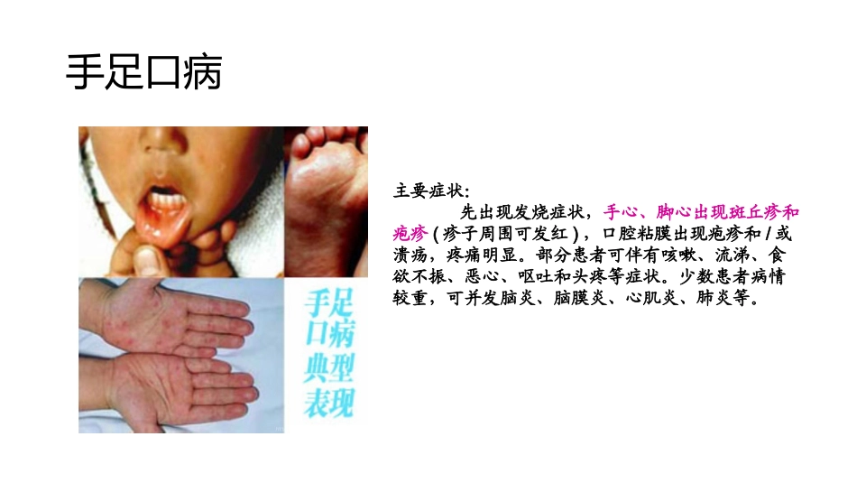 幼儿园传染病健康教育_第3页