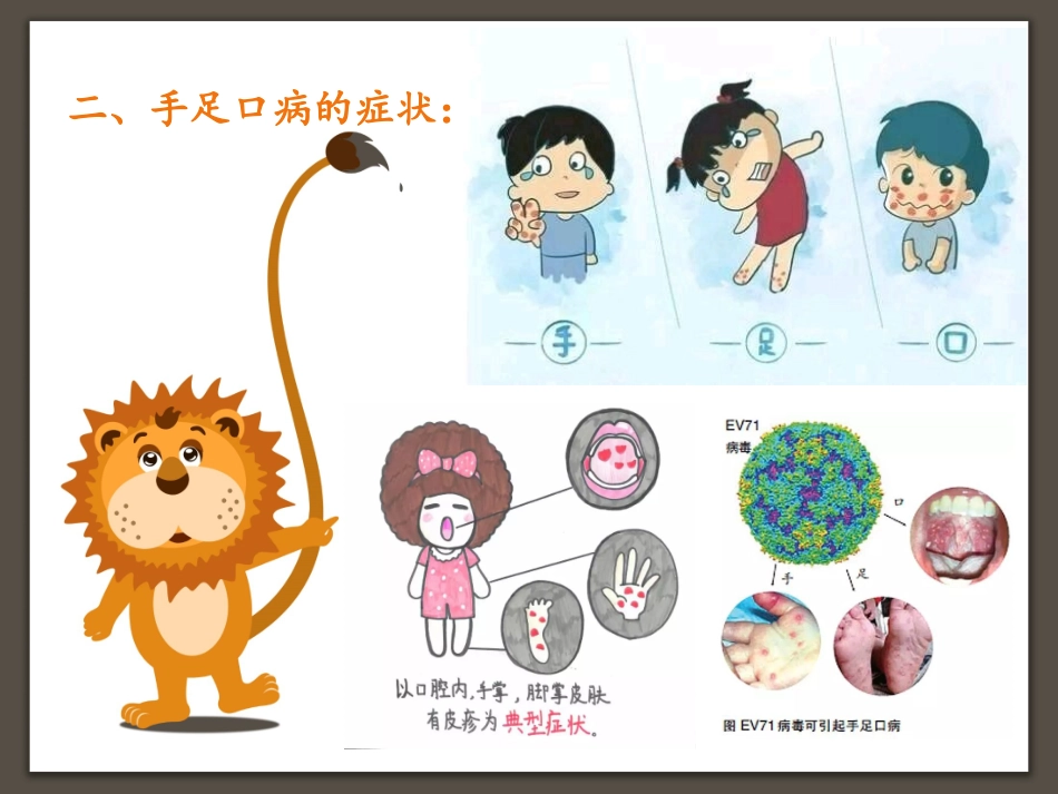幼儿园传染病主题课件手足口病要预防_第3页