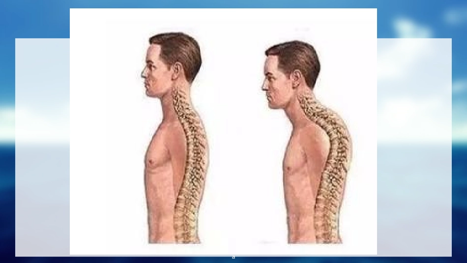 幼儿园大班健康课保护骨骼课件_第3页