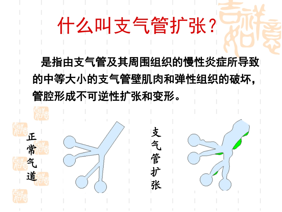 支气管扩张伴咯血怎么办_第2页