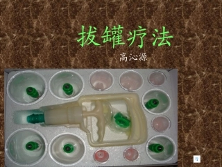 中医拔罐疗法