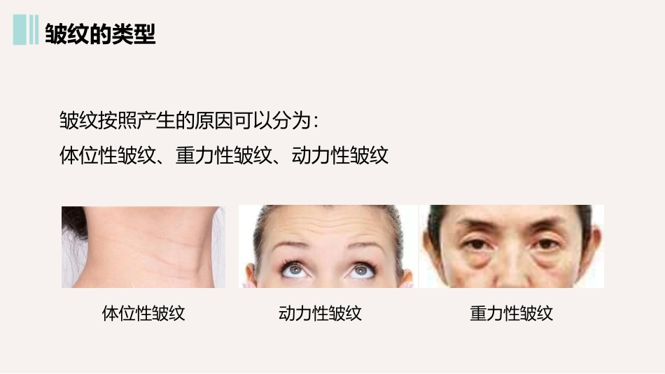 皱纹的类型及解剖学基础_第3页