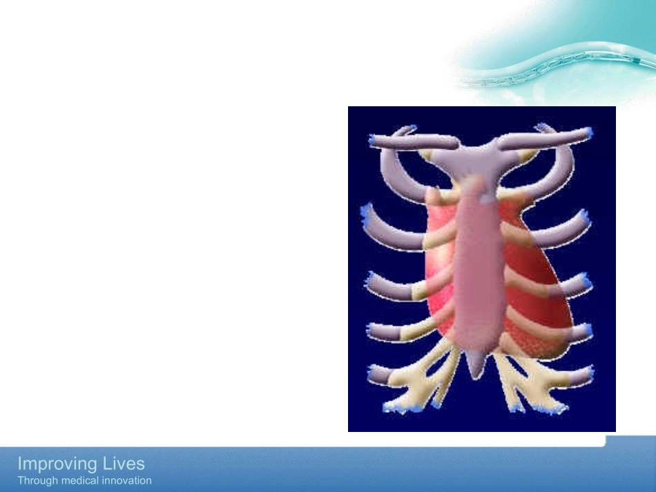 PTCA基础知识_第3页