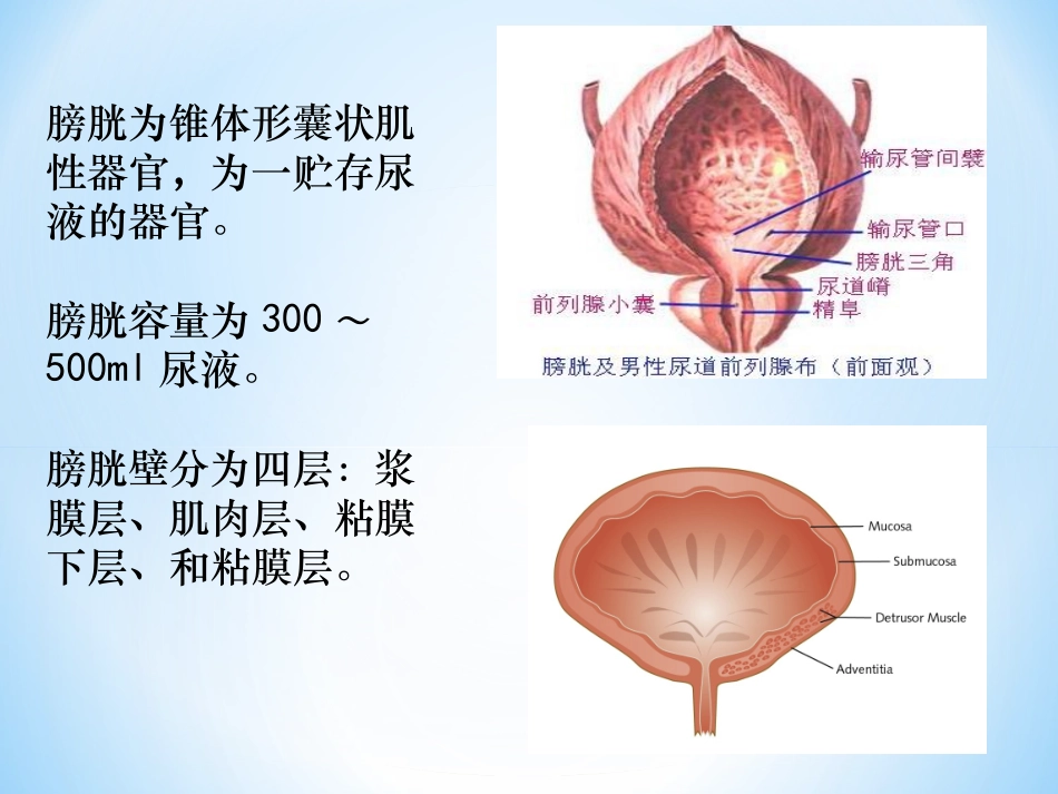 膀胱癌根治术患者的护理查房课件_第3页