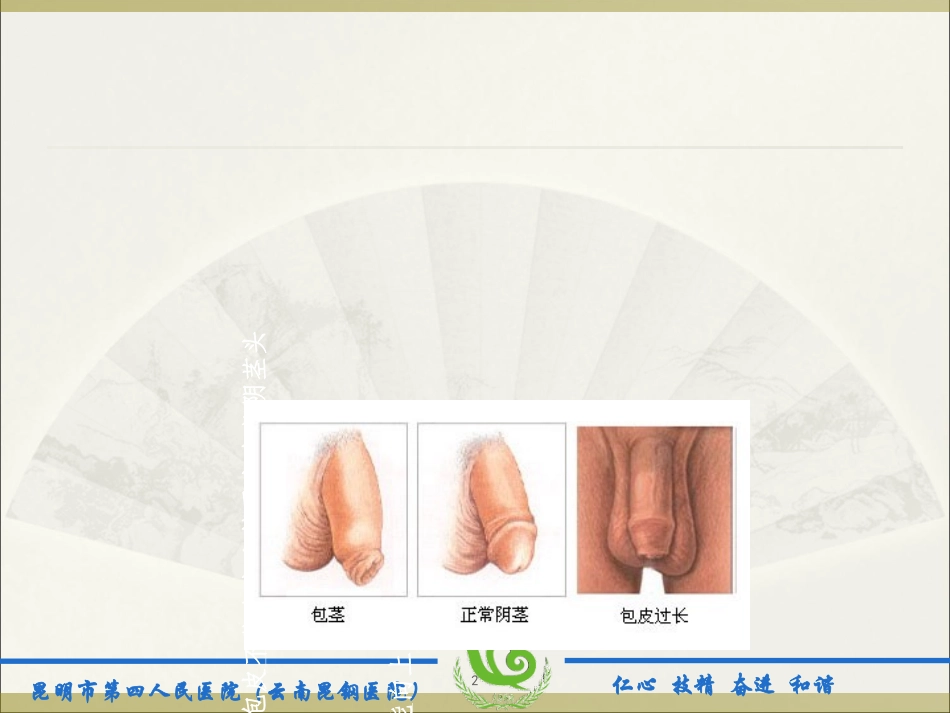 包茎包皮过长课件_第2页