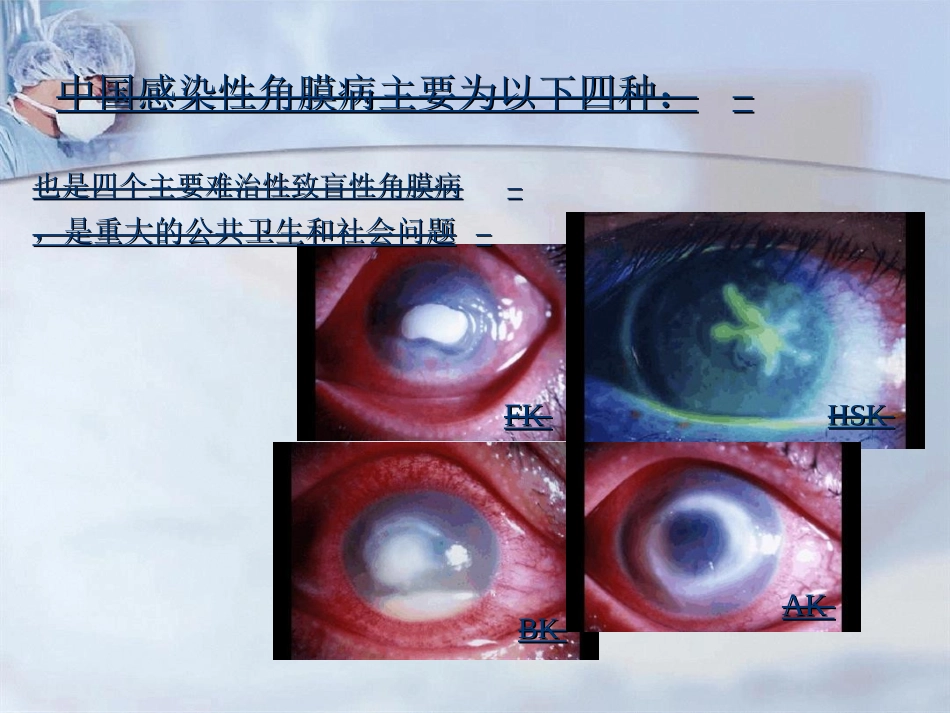 病毒性角膜炎课件_第2页