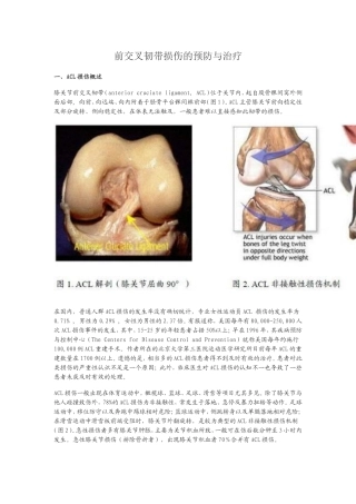 前交叉韧带损伤的预防与治疗