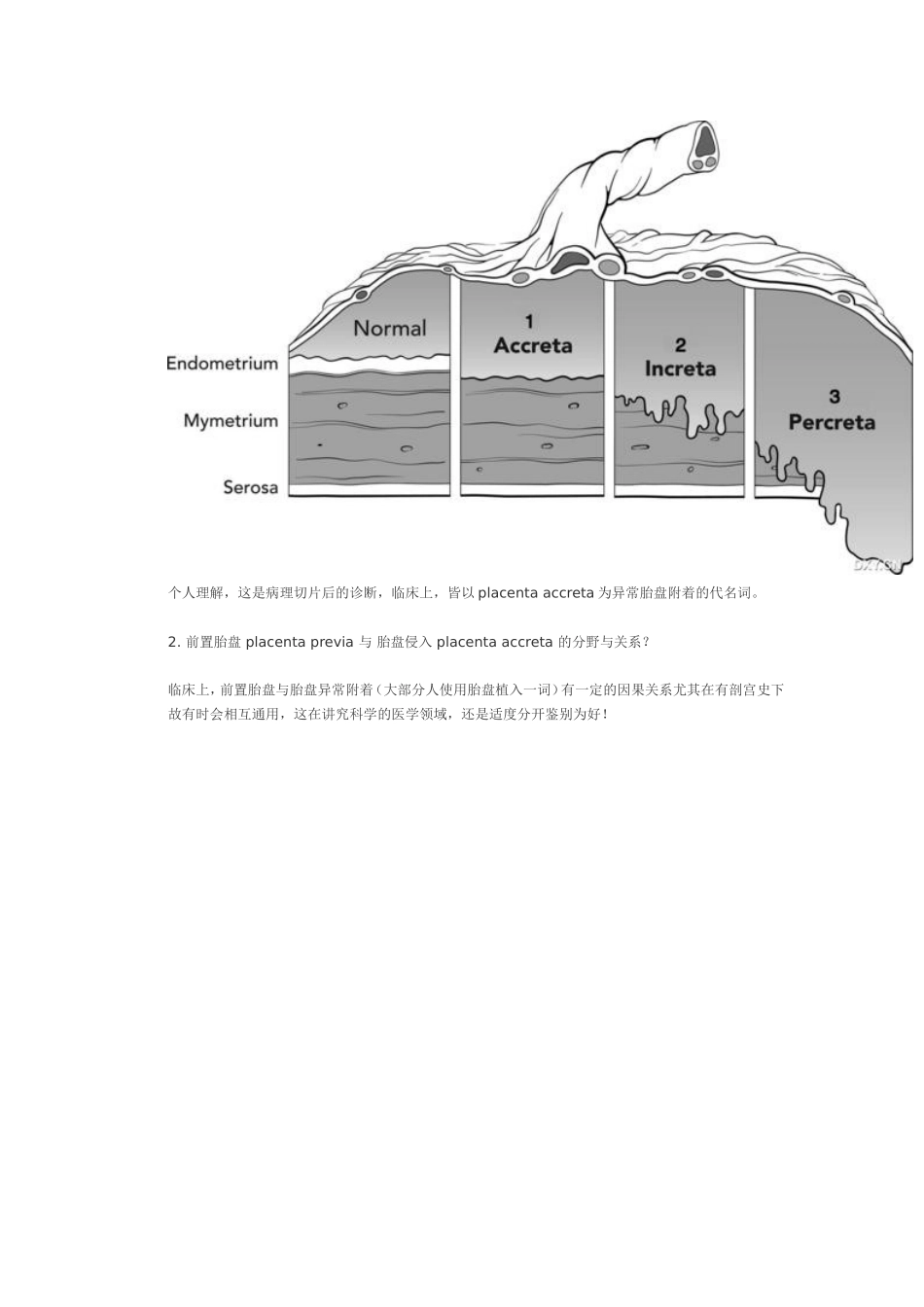 前置胎盘的麻醉_第3页