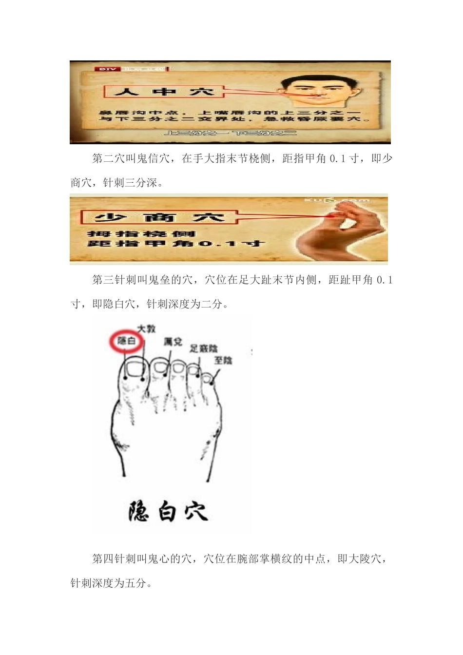 再谈鬼门十三针_第2页