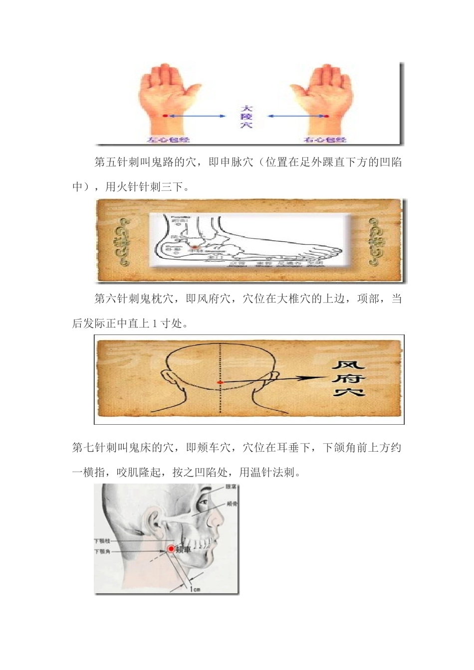 再谈鬼门十三针_第3页