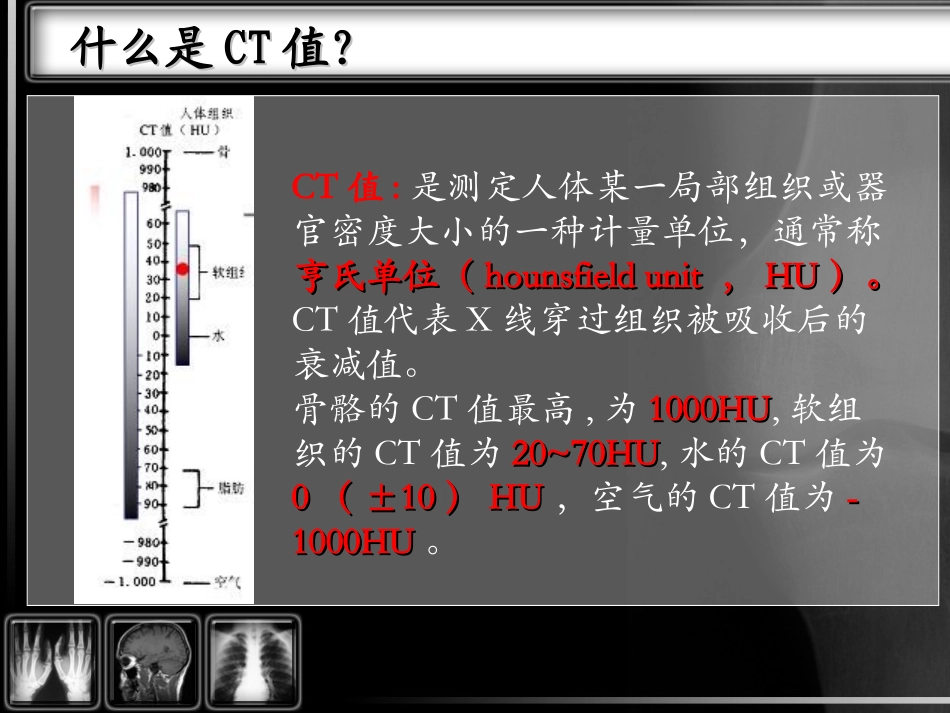 CT基本知识介绍_第2页
