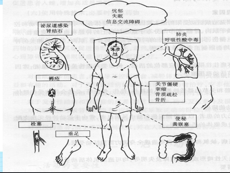 ICU病人的功能锻炼_第3页