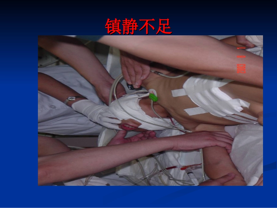 ICU镇静镇痛药物的合理使用_第3页