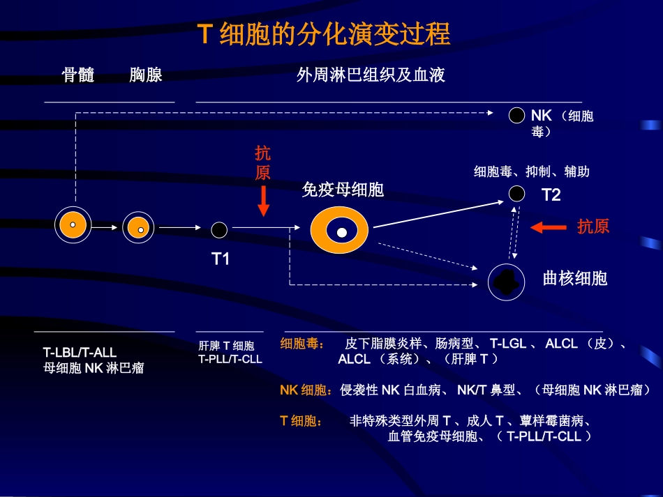 NKT细胞淋巴瘤_第3页