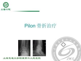 Pilon骨折治疗